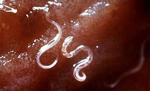 Hookworms (Ancylostoma Caninum)