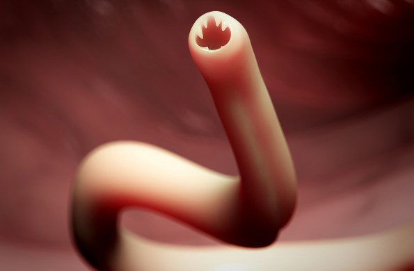 hookworm