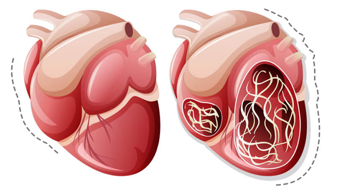 heartworm disease