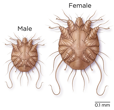 Sarcoptes mites (Sarcoptes scabiei var. canis)