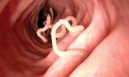 Tapeworm